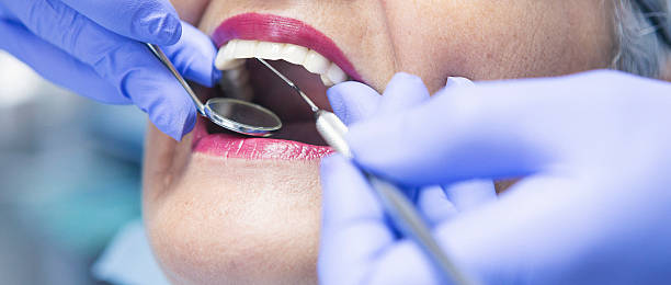 Best Teeth Whitening  in Okolona, MS